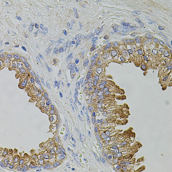 Immunohistochemistry - TRPA1 Polyclonal Antibody 