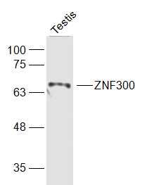 Fig2: Sample:; Testis (Mouse) Lysate at 40 ug; Primary: Anti-ZNF300 at 1/1000 dilution; Secondary: IRDye800CW Goat Anti-Rabbit IgG at 1/20000 dilution; Predicted band size: 68 kD; Observed band size: 68 kD