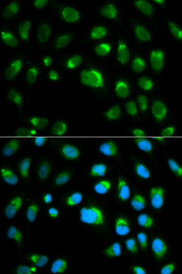 Immunofluorescence - TLR1 Polyclonal Antibody 