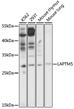Western blot - LAPTM5 Polyclonal Antibody 