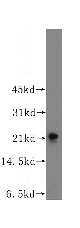 mouse brain tissue were subjected to SDS PAGE followed by western blot with Catalog No:115992(TAGLN3 antibody) at dilution of 1:800