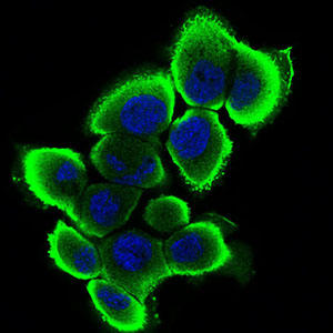 Fig3: ICC staining SERPINA7 (green) in A431 cells. The nuclear counter stain is DAPI (blue). Cells were fixed in paraformaldehyde, permeabilised with 0.25% Triton X100/PBS.