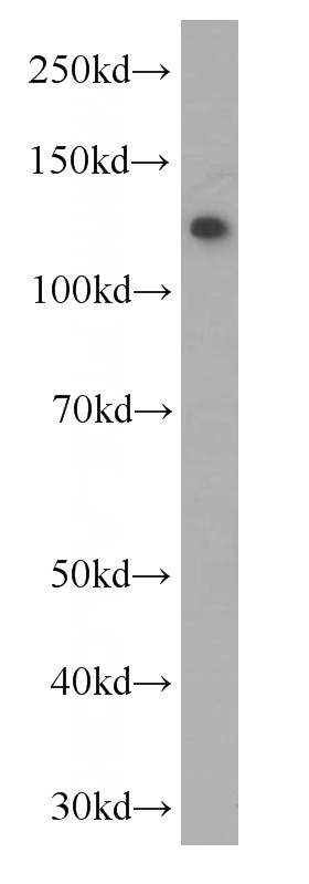 human blood tissue were subjected to SDS PAGE followed by western blot with Catalog No:107027(C3 Antibody) at dilution of 1:1000