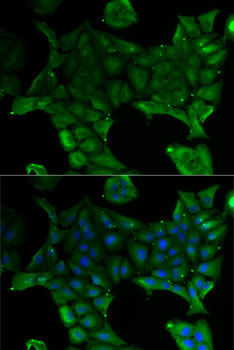 Immunofluorescence - SLC34A1 Polyclonal Antibody 