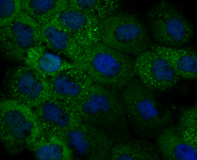 Fig2: ICC staining IL-31 (green) in A431 cells. The nuclear counter stain is DAPI (blue). Cells were fixed in paraformaldehyde, permeabilised with 0.25% Triton X100/PBS.