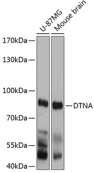 Western blot - DTNA Polyclonal Antibody 