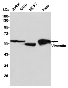 Western blot detection of Vimentin in Jurkat,A549,MCF7 and Hela cell lysates using Vimentin mouse mAb (1:5000 diluted).Predicted band size:57KDa.Observed band size:57KDa.