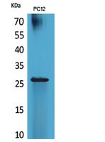 Fig1:; Western Blot analysis of PC12 cells using POLR3G Polyclonal Antibody.. Secondary antibody（catalog#: HA1001) was diluted at 1:20000 cells nucleus extracted by Minute TM Cytoplasmic and Nuclear Fractionation kit (SC-003,Inventbiotech,MN,USA).