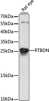 Western blot - RTBDN Polyclonal Antibody 