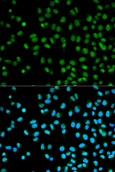 Immunofluorescence - CST8 Polyclonal Antibody 