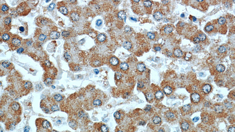 Immunohistochemical of paraffin-embedded human liver using Catalog No:107189(CYB5R3 antibody) at dilution of 1:50 (under 40x lens)