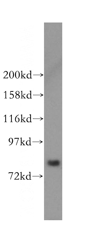 human brain tissue were subjected to SDS PAGE followed by western blot with Catalog No:112571(MDM1-Specific antibody) at dilution of 1:300