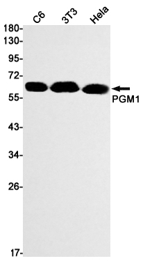 Western blot detection of PGM1 in C6,3T3,Hela cell lysates using PGM1 Rabbit mAb(1:1000 diluted).Predicted band size:62kDa.Observed band size:62kDa.