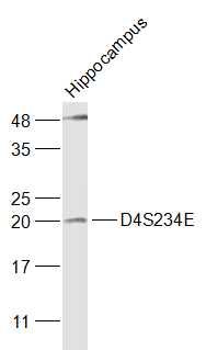 Fig2: Sample:; Hippocampus (Mouse) Lysate at 40 ug; Primary: Anti-D4S234E at 1/1000 dilution; Secondary: IRDye800CW Goat Anti-Rabbit IgG at 1/20000 dilution; Predicted band size: 21 kD; Observed band size: 21 kD
