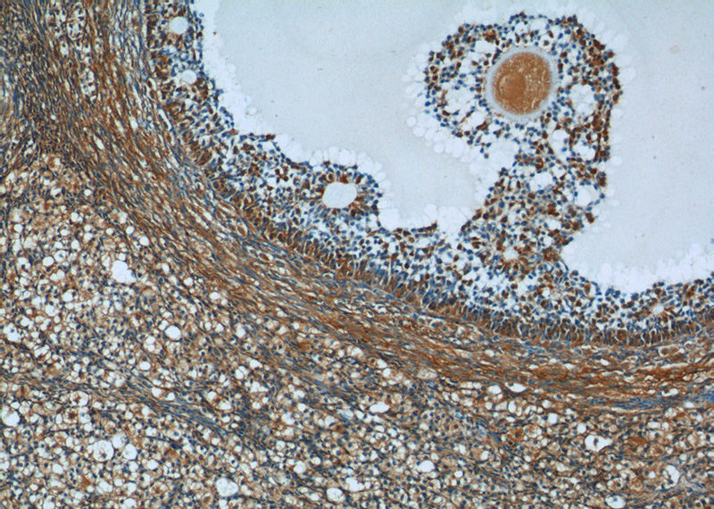 Immunohistochemistry of paraffin-embedded human ovary tissue slide using Catalog No:110296(ECOP Antibody) at dilution of 1:50 (under 10x lens)