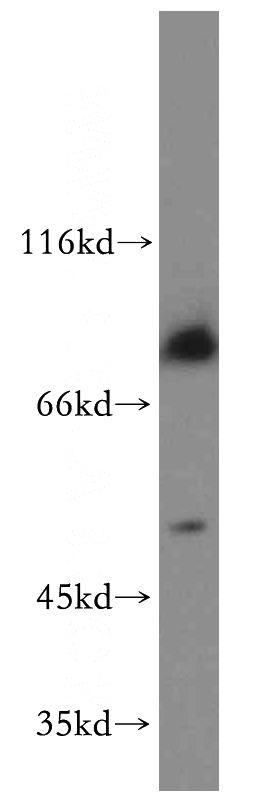 mouse brain tissue were subjected to SDS PAGE followed by western blot with Catalog No:107888(ADRA1A-Specific antibody) at dilution of 1:300
