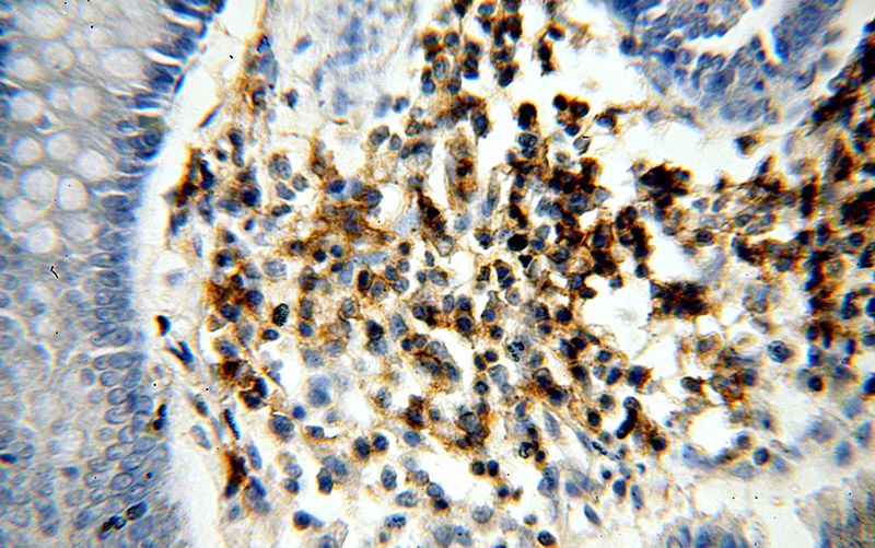 Immunohistochemical of paraffin-embedded human colon using Catalog No:111591(ICAM3 antibody) at dilution of 1:100 (under 40x lens)