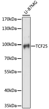 Western blot - TCF25 Polyclonal Antibody 