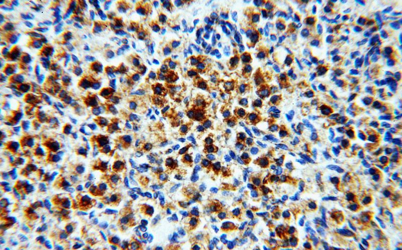 Immunohistochemical of paraffin-embedded human ovary using Catalog No:113499(PAK2 antibody) at dilution of 1:100 (under 40x lens)