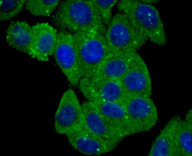 Fig2: ICC staining BLCAP (green) in HepG2 cells. The nuclear counter stain is DAPI (blue). Cells were fixed in paraformaldehyde, permeabilised with 0.25% Triton X100/PBS.