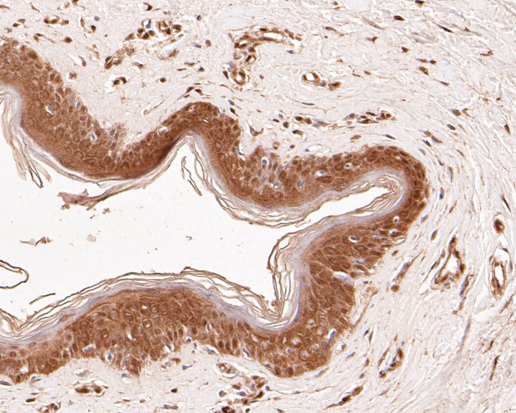 Fig6: Immunohistochemical analysis of paraffin-embedded human skin tissue using anti-SPATA5L1 antibody. The section was pre-treated using heat mediated antigen retrieval with Tris-EDTA buffer (pH 8.0-8.4) for 20 minutes.The tissues were blocked in 5% BSA for 30 minutes at room temperature, washed with ddH2O and PBS, and then probed with the primary antibody ( 1/50) for 30 minutes at room temperature. The detection was performed using an HRP conjugated compact polymer system. DAB was used as the chromogen. Tissues were counterstained with hematoxylin and mounted with DPX.