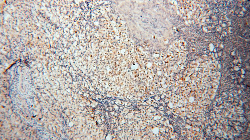 Immunohistochemical of paraffin-embedded human ovary using Catalog No:109185(CEP70 antibody) at dilution of 1:50 (under 10x lens)