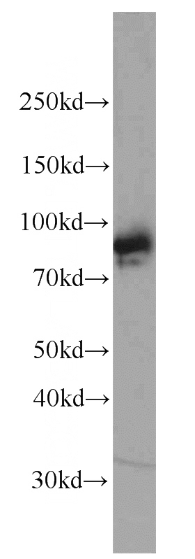 human heart tissue were subjected to SDS PAGE followed by western blot with Catalog No:113875(PIK3R6 antibody) at dilution of 1:1000
