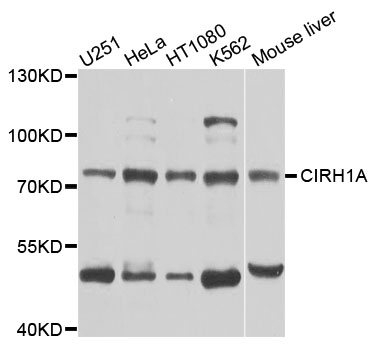 Western blot - CIRH1A Polyclonal Antibody 