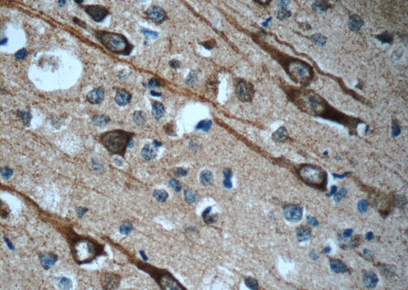 Immunohistochemistry of paraffin-embedded human brain slide using Catalog No:109181(KIAA1712 Antibody) at dilution of 1:50 (under 40x lens)