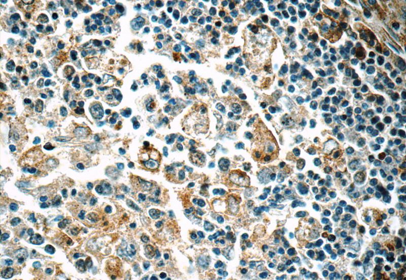 Immunohistochemistry of paraffin-embedded human spleen tissue slide using Catalog No:109043(CD11c/Integrin alpha X Antibody) at dilution of 1:50 (under 40x lens)