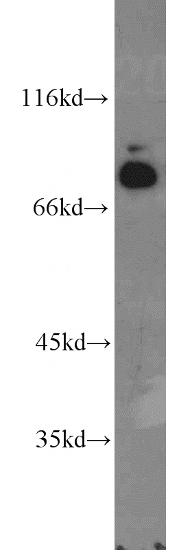 HeLa cells were subjected to SDS PAGE followed by western blot with Catalog No:111238(GTF3C4 antibody) at dilution of 1:1600