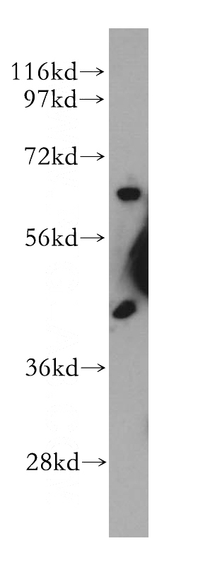 human brain tissue were subjected to SDS PAGE followed by western blot with Catalog No:111091(GPC5 antibody) at dilution of 1:300