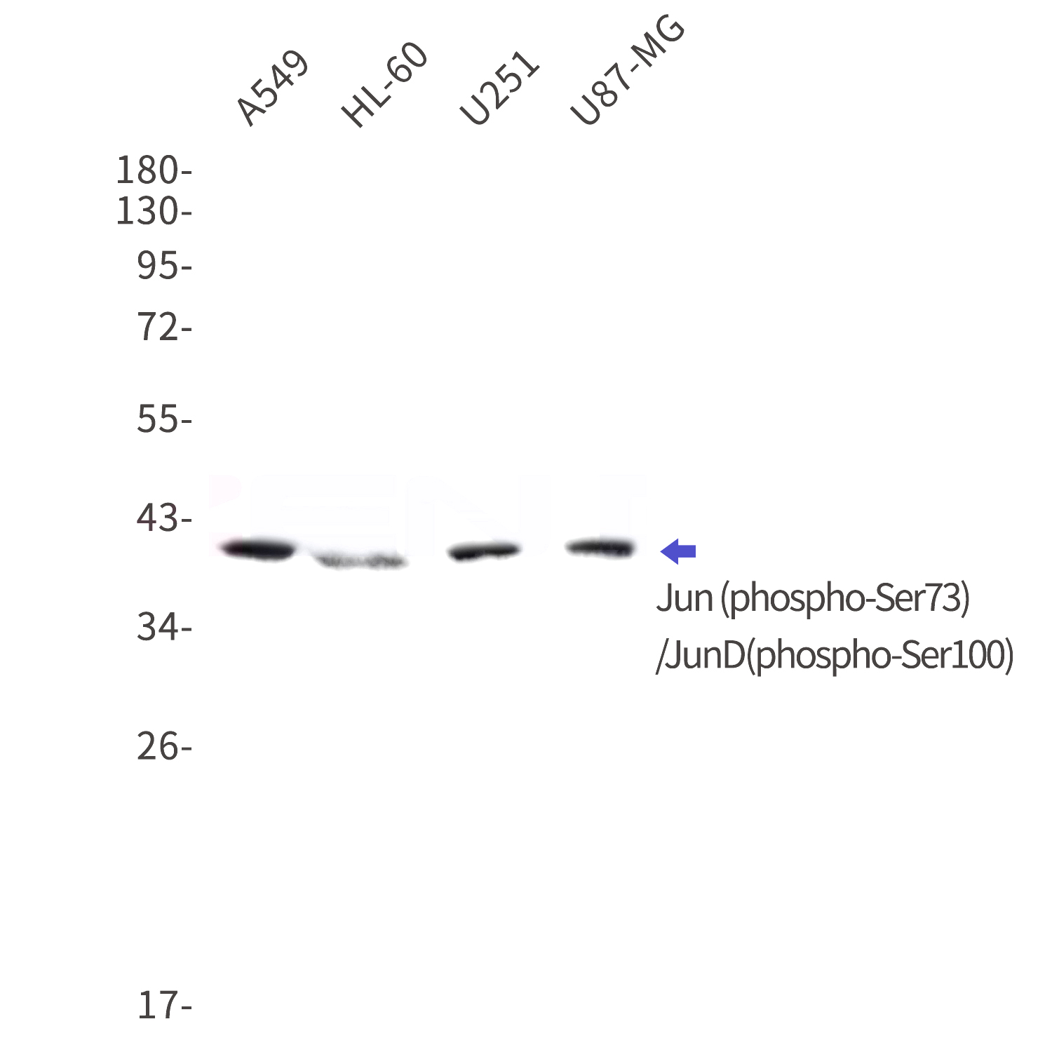 Western blot detection of Jun (phospho-Ser73)/JunD (phospho-Ser100) in A549,HL-60,U251,U87-MG cell lysates using Jun (phospho-Ser73)/JunD (phospho-Ser100) Rabbit mAb(1:1000 diluted).Predicted band size:35,36kDa.Observed band size:38,42,48kDa.