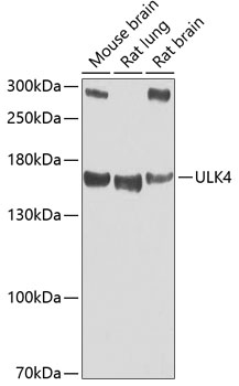 Western blot - ULK4 Polyclonal Antibody 