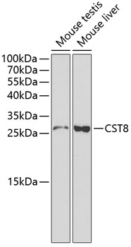 Western blot - CST8 Polyclonal Antibody 