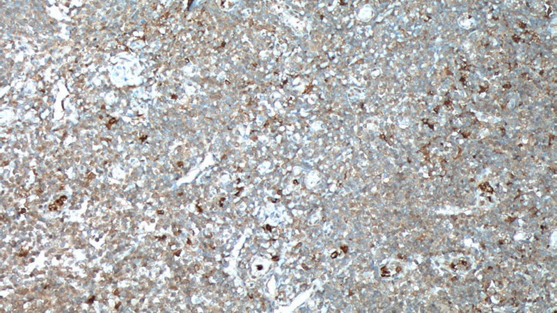 Immunohistochemistry of paraffin-embedded human tonsillitis tissue slide using Catalog No:111610(IDO1 Antibody) at dilution of 1:100 (under 10x lens). heat mediated antigen retrieved with Tris-EDTA buffer(pH9).