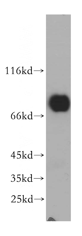 HEK-293 cells were subjected to SDS PAGE followed by western blot with Catalog No:112499(MAVS; VISA antibody) at dilution of 1:500