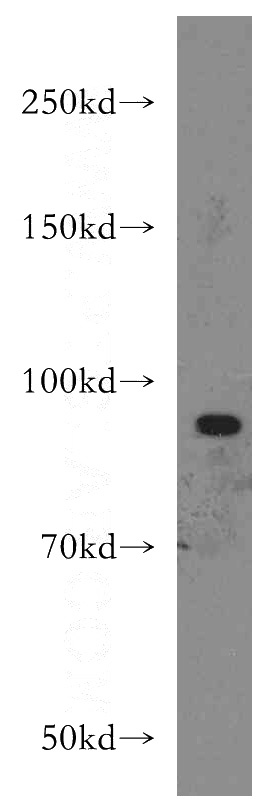 Jurkat cells were subjected to SDS PAGE followed by western blot with Catalog No:116996(XPR1 antibody) at dilution of 1:500