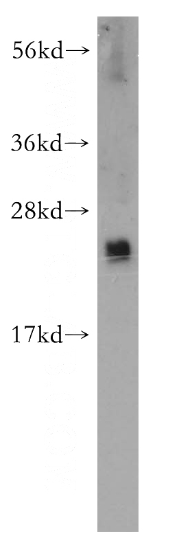 human placenta tissue were subjected to SDS PAGE followed by western blot with Catalog No:113824(PHLDA2 antibody) at dilution of 1:300