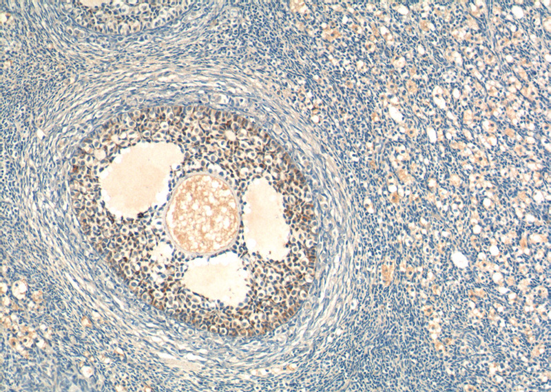 Immunohistochemistry of paraffin-embedded human ovary tissue slide using Catalog No:107992(AMH Antibody) at dilution of 1:200 (under 10x lens)