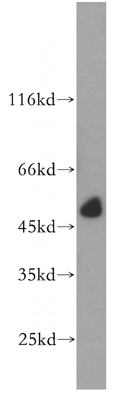human kidney tissue were subjected to SDS PAGE followed by western blot with Catalog No:114276(PRR5 antibody) at dilution of 1:500