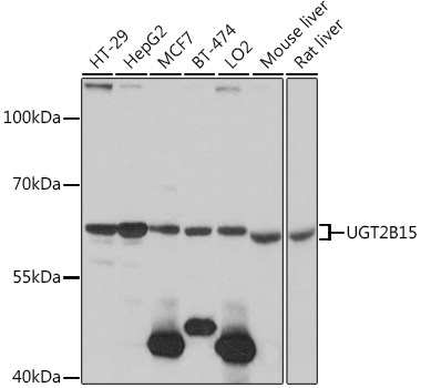 Western blot - UGT2B15 Polyclonal Antibody 
