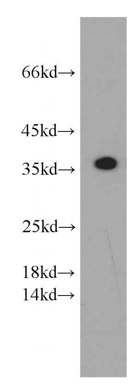 human skeletal muscle tissue were subjected to SDS PAGE followed by western blot with Catalog No:114994(SCGF antibody) at dilution of 1:500