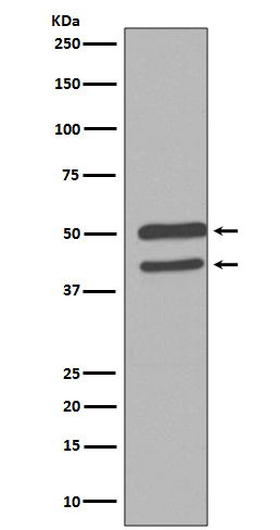 Western blot analysis of JNK1/2/3 Antibody expression in HeLa cell lysate.