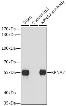 Immunoprecipitation - KPNA2 Polyclonal Antibody 