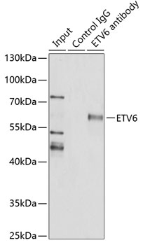 Immunoprecipitation - ETV6 Polyclonal Antibody 
