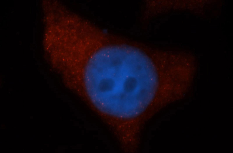 Immunofluorescent analysis of MCF-7 cells, using UROS antibody Catalog No:116578 at 1:50 dilution and Rhodamine-labeled goat anti-rabbit IgG (red). Blue pseudocolor = DAPI (fluorescent DNA dye).