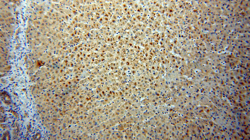 Immunohistochemical of paraffin-embedded human liver using Catalog No:110624(fetuin-B antibody) at dilution of 1:50 (under 10x lens)