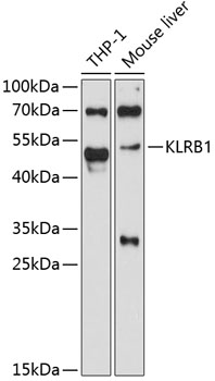 Western blot - KLRB1 Polyclonal Antibody 