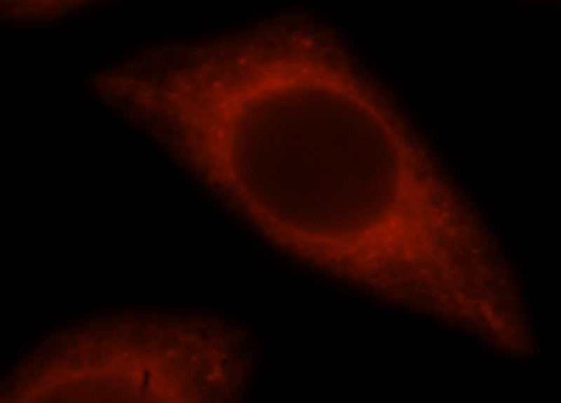 Immunofluorescent analysis of Hela cells, using BCAP29 antibody Catalog No:108420 at 1:25 dilution and Rhodamine-labeled goat anti-rabbit IgG (red).
